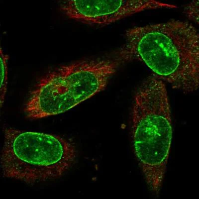 Immunocytochemistry/ Immunofluorescence - Anti-NEK1 antibody (AB186519)