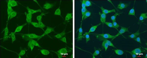 Immunocytochemistry/ Immunofluorescence - Anti-NEK1 antibody (AB229489)