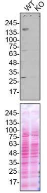Western blot - Anti-NEK1 antibody (AB229489)