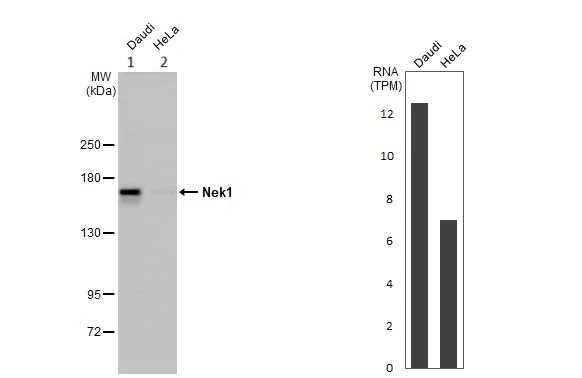 Western blot - Anti-NEK1 antibody (AB229489)