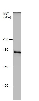 Western blot - Anti-NEK1 antibody (AB229489)