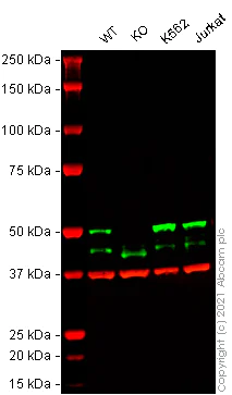 Western blot - Anti-NEK2 antibody [20/NEK2] (AB279717)