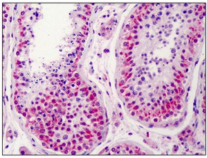 Immunohistochemistry (Formalin/PFA-fixed paraffin-embedded sections) - Anti-NEK2 antibody (AB115731), expandable thumbnail