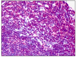 Immunohistochemistry (Formalin/PFA-fixed paraffin-embedded sections) - Anti-NEK2 antibody (AB115731), expandable thumbnail