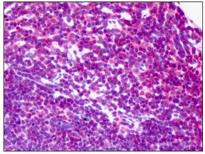 Immunohistochemistry (Formalin/PFA-fixed paraffin-embedded sections) - Anti-NEK2 antibody (AB115731)