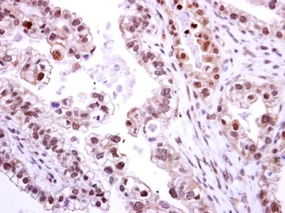 Immunohistochemistry (Formalin/PFA-fixed paraffin-embedded sections) - Anti-NEK2 antibody (AB227958)