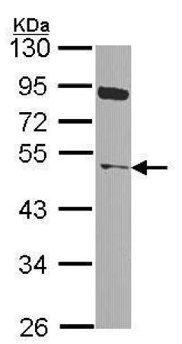 Western blot - Anti-NEK2 antibody (AB227958)