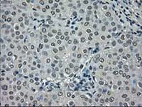 Immunohistochemistry (Formalin/PFA-fixed paraffin-embedded sections) - Anti-NEK6 antibody [OTI2H7] (AB117986)