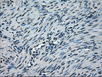 Immunohistochemistry (Formalin/PFA-fixed paraffin-embedded sections) - Anti-NEK6 antibody [OTI2H7] (AB117986)