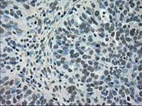 Immunohistochemistry (Formalin/PFA-fixed paraffin-embedded sections) - Anti-NEK6 antibody [OTI2H7] (AB117986)