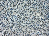 Immunohistochemistry (Formalin/PFA-fixed paraffin-embedded sections) - Anti-NEK6 antibody [OTI2H7] (AB117986)