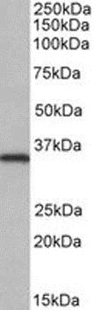 Western blot - Anti-NEK7 antibody (AB166776)