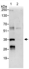 Immunoprecipitation - Anti-NEK7 antibody (AB95873), expandable thumbnail