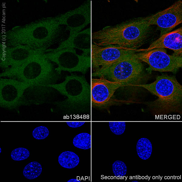 Immunocytochemistry/ Immunofluorescence - Anti-NEK9 antibody [EP7361] (AB138488), expandable thumbnail