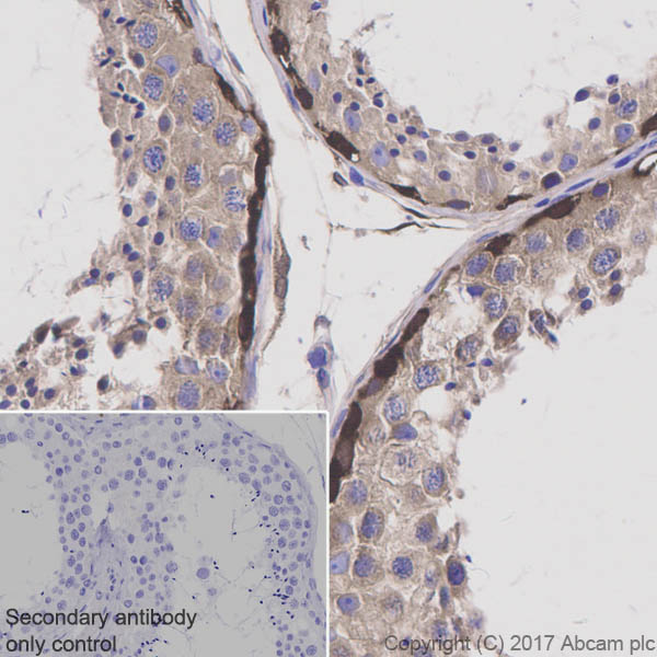 Immunohistochemistry (Formalin/PFA-fixed paraffin-embedded sections) - Anti-NEK9 antibody [EP7361] (AB138488), expandable thumbnail