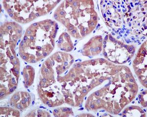 Immunohistochemistry (Formalin/PFA-fixed paraffin-embedded sections) - Anti-NEK9 antibody [EP7361] (ab138488), expandable thumbnail