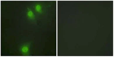 Immunocytochemistry/ Immunofluorescence - Anti-NEK9 (phospho T210) antibody (AB63553)