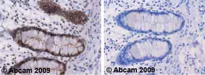 Immunohistochemistry (Formalin/PFA-fixed paraffin-embedded sections) - Anti-NEK9 (phospho T210) antibody (AB63553)