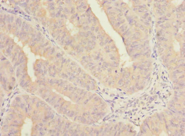 Immunohistochemistry (Formalin/PFA-fixed paraffin-embedded sections) - Anti-NELF-B antibody (AB237027)