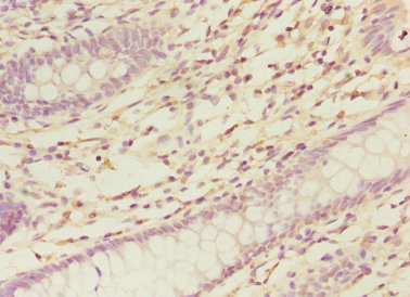 Immunohistochemistry (Formalin/PFA-fixed paraffin-embedded sections) - Anti-NELF-B antibody (AB237027)