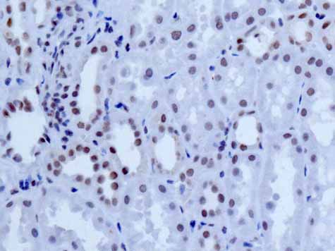 Anti-NELF-B antibody [EPR11200]