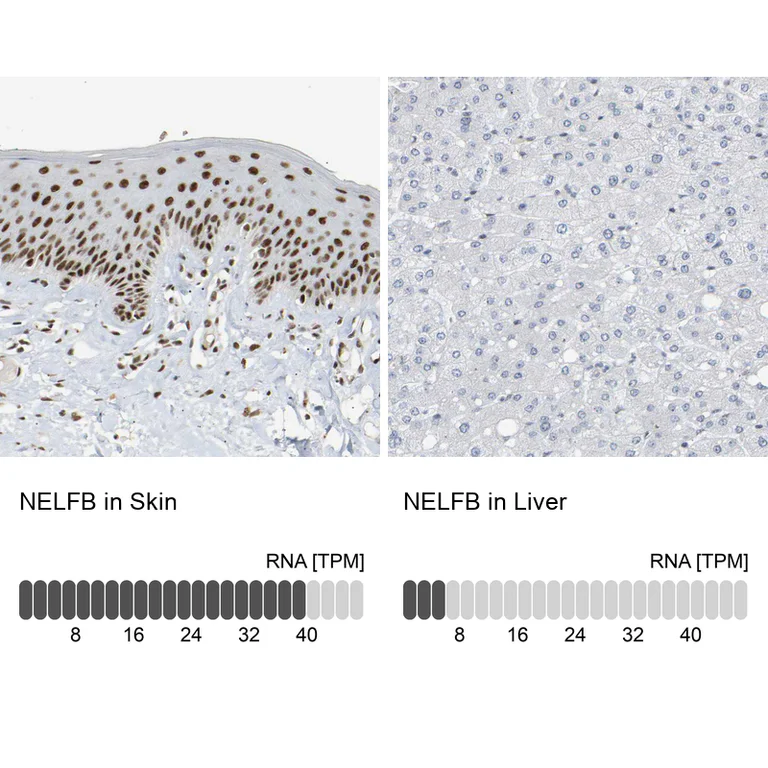 Immunohistochemistry (Formalin/PFA-fixed paraffin-embedded sections) - Anti-NELFB Antibody (AB327200)