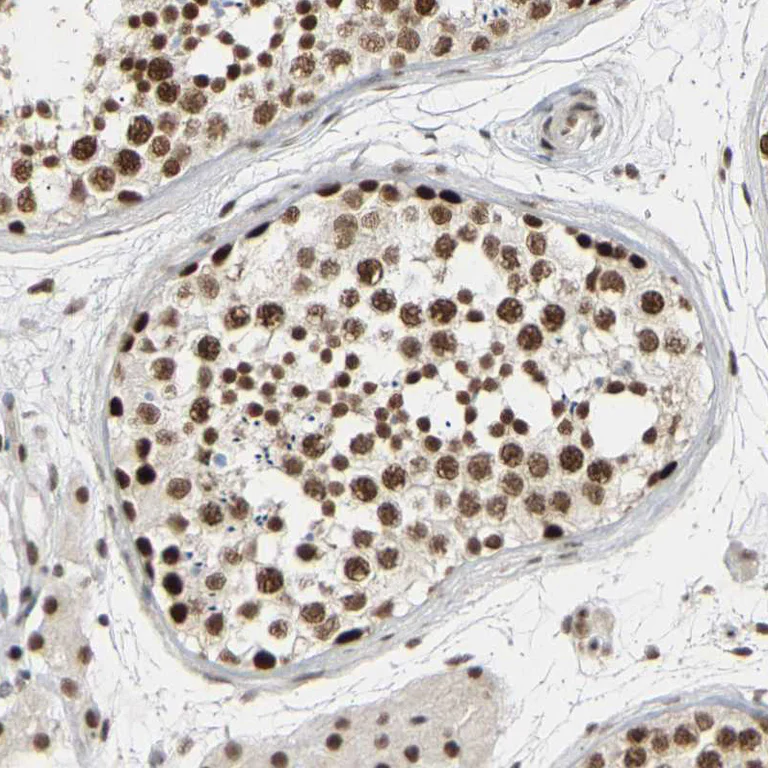 Immunohistochemistry (Formalin/PFA-fixed paraffin-embedded sections) - Anti-NELFB Antibody (AB327200)