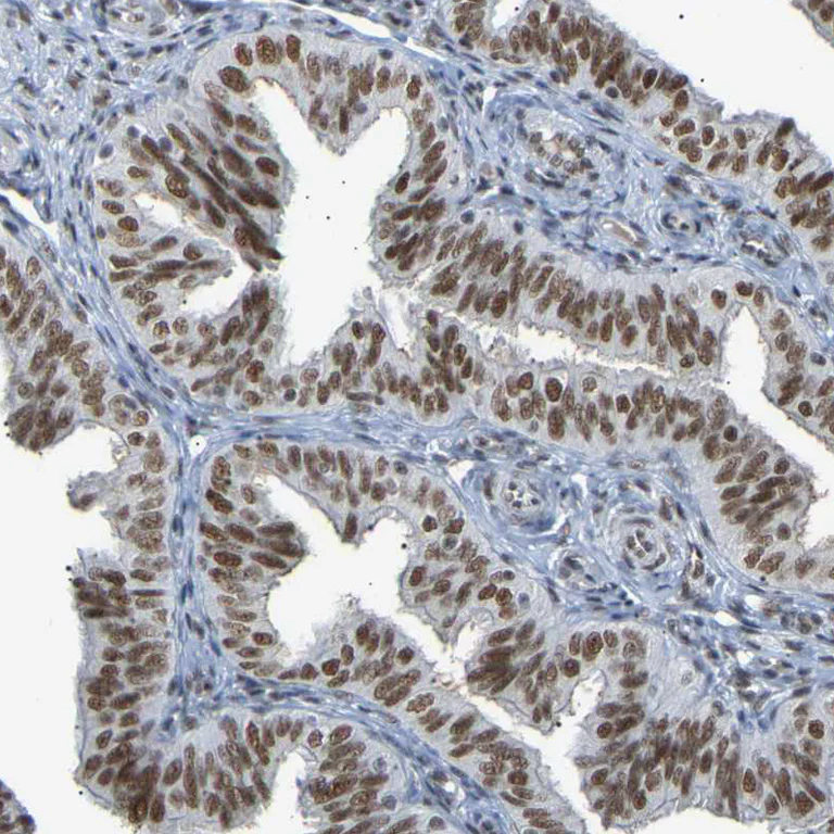 Immunohistochemistry (Formalin/PFA-fixed paraffin-embedded sections) - Anti-NELFB Antibody (AB327200)
