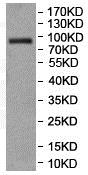 Western blot - Anti-NELL1 antibody (AB197315), expandable thumbnail