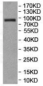 Western blot - Anti-NELL1 antibody (AB197315)