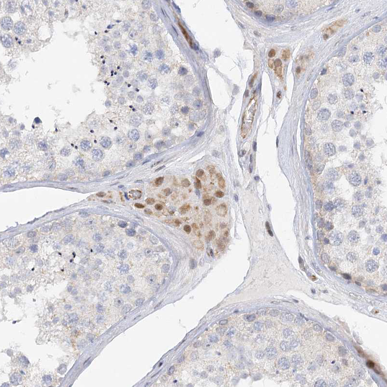 Immunohistochemistry (Formalin/PFA-fixed paraffin-embedded sections) - Anti-NELL2 antibody (AB240781), expandable thumbnail