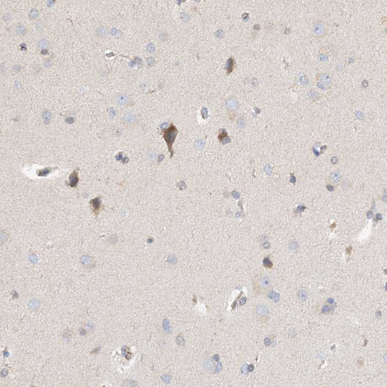 Immunohistochemistry (Formalin/PFA-fixed paraffin-embedded sections) - Anti-NELL2 antibody (AB240781), expandable thumbnail