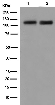 Western blot - Anti-NELL2 antibody [EPR13538] (AB182002)
