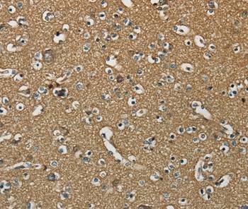 Immunohistochemistry (Formalin/PFA-fixed paraffin-embedded sections) - Anti-NEMF antibody (AB200382), expandable thumbnail