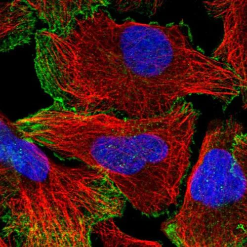 Immunocytochemistry/ Immunofluorescence - Anti-Neogenin antibody (AB244408)