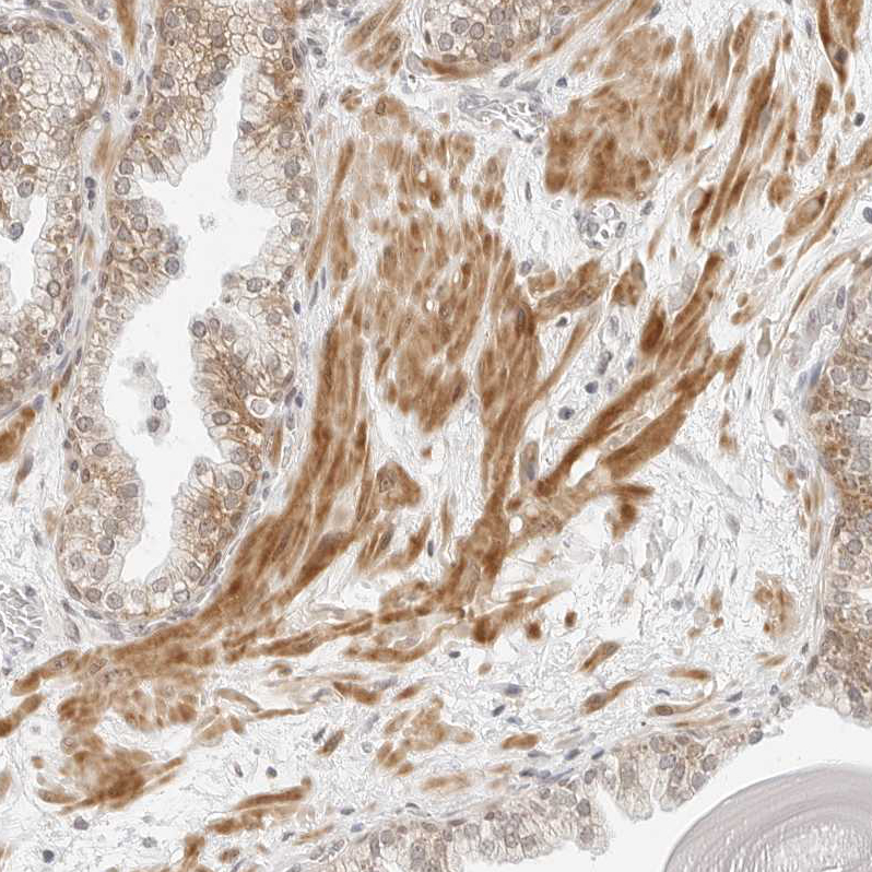 Immunohistochemistry (Formalin/PFA-fixed paraffin-embedded sections) - Anti-Neogenin antibody (AB244408)