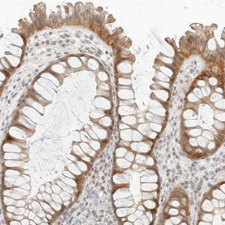 Immunohistochemistry (Formalin/PFA-fixed paraffin-embedded sections) - Anti-Neogenin antibody (AB244408)