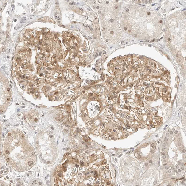Immunohistochemistry (Formalin/PFA-fixed paraffin-embedded sections) - Anti-Neogenin antibody (AB244408)