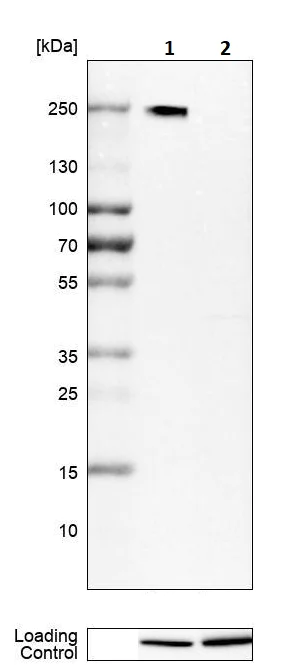 Western blot - Anti-Neogenin antibody (AB244408)