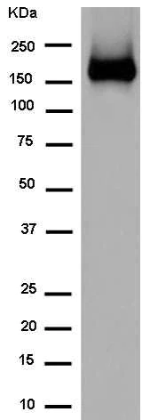 Western blot - Anti-Neogenin antibody [EPR14696] (AB183511)