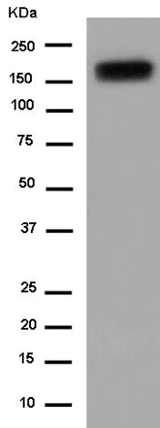 Western blot - Anti-Neogenin antibody [EPR14696] (AB183511)