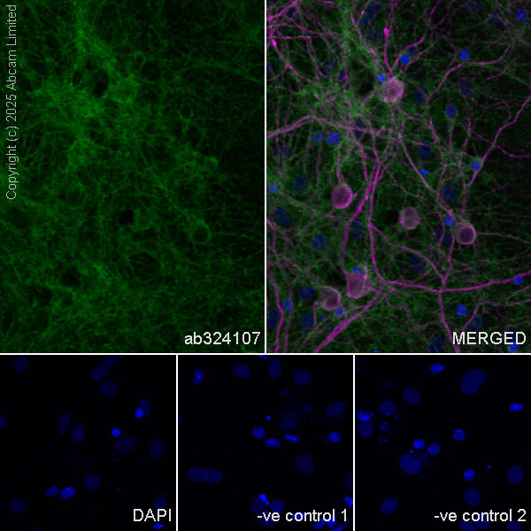 Immunocytochemistry/ Immunofluorescence - Anti-Neogenin antibody [EPR30444-522] (AB324107)