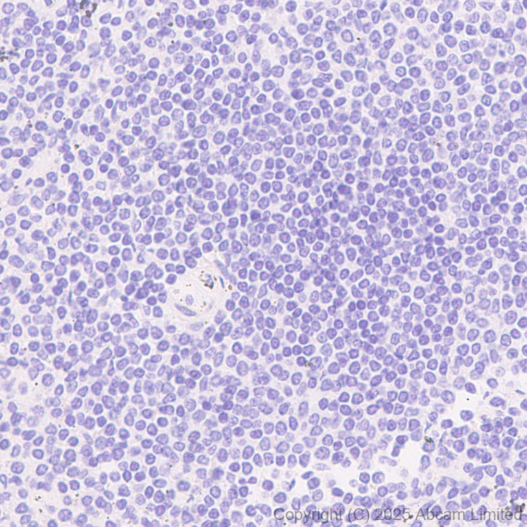 Immunohistochemistry (Formalin/PFA-fixed paraffin-embedded sections) - Anti-Neogenin antibody [EPR30444-522] (AB324107)