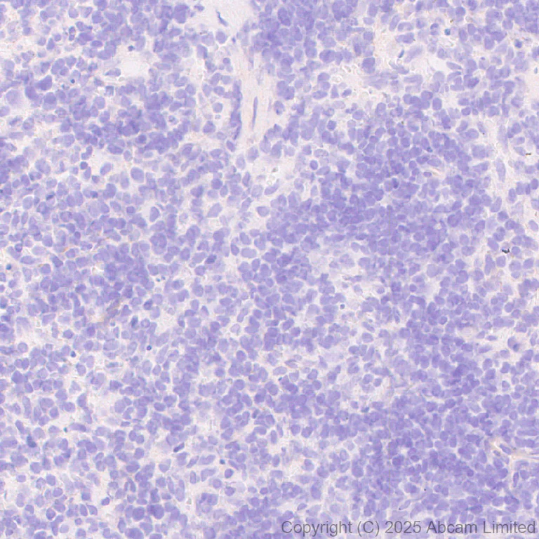 Immunohistochemistry (Formalin/PFA-fixed paraffin-embedded sections) - Anti-Neogenin antibody [EPR30444-522] (AB324107)