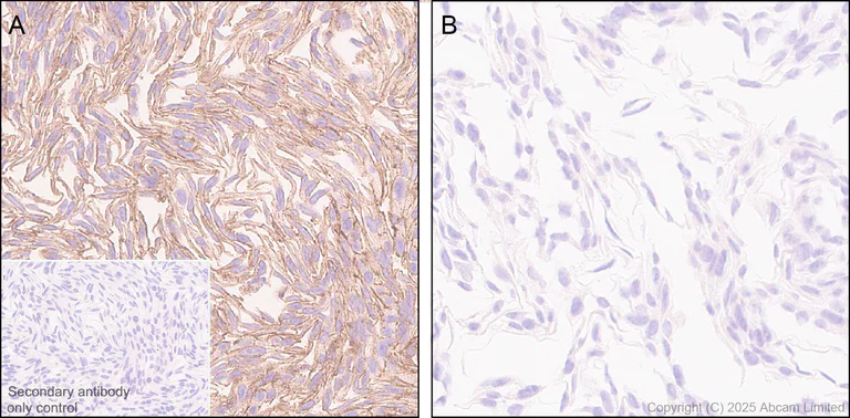 Immunohistochemistry (Formalin/PFA-fixed paraffin-embedded sections) - Anti-Neogenin antibody [EPR30444-522] (AB324107)