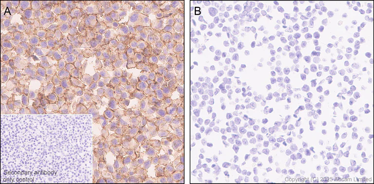 Immunohistochemistry (Formalin/PFA-fixed paraffin-embedded sections) - Anti-Neogenin antibody [EPR30444-522] (AB324107)