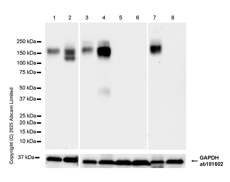 Western blot - Anti-Neogenin antibody [EPR30444-522] (AB324107)