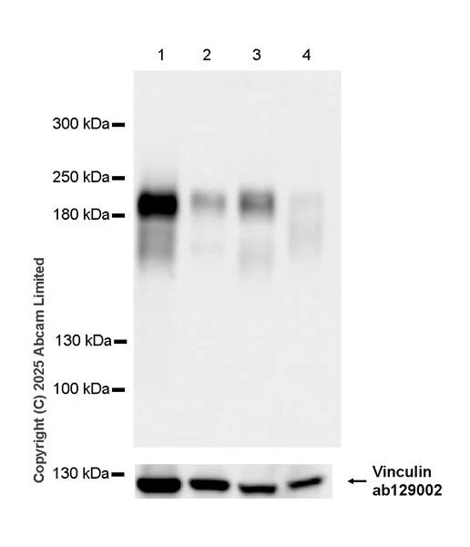 Western blot - Anti-Neogenin antibody [EPR30444-522] (AB324107)