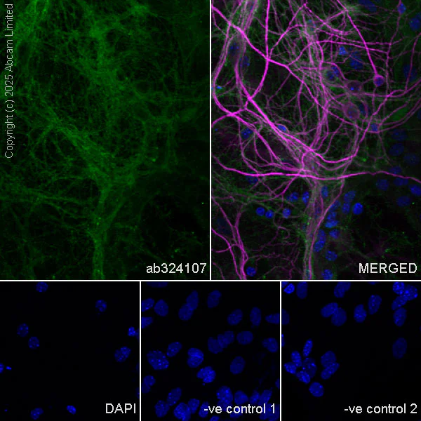 Immunocytochemistry/ Immunofluorescence - Anti-Neogenin antibody [EPR30444-522] - BSA and Azide free (AB326594)