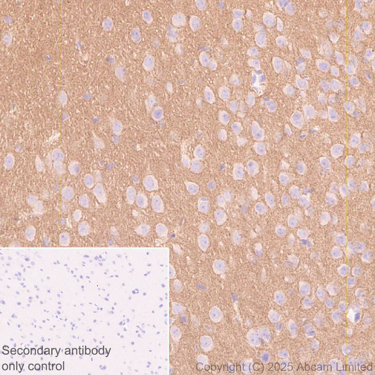 Immunohistochemistry (Formalin/PFA-fixed paraffin-embedded sections) - Anti-Neogenin antibody [EPR30444-522] - BSA and Azide free (AB326594)